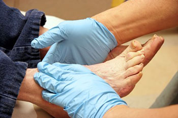 Diabetic foot care services